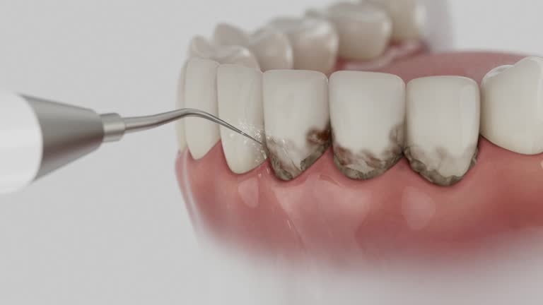 Reliable Dental Implants contractor in Sheldon, IL by Smile Center Dentistry